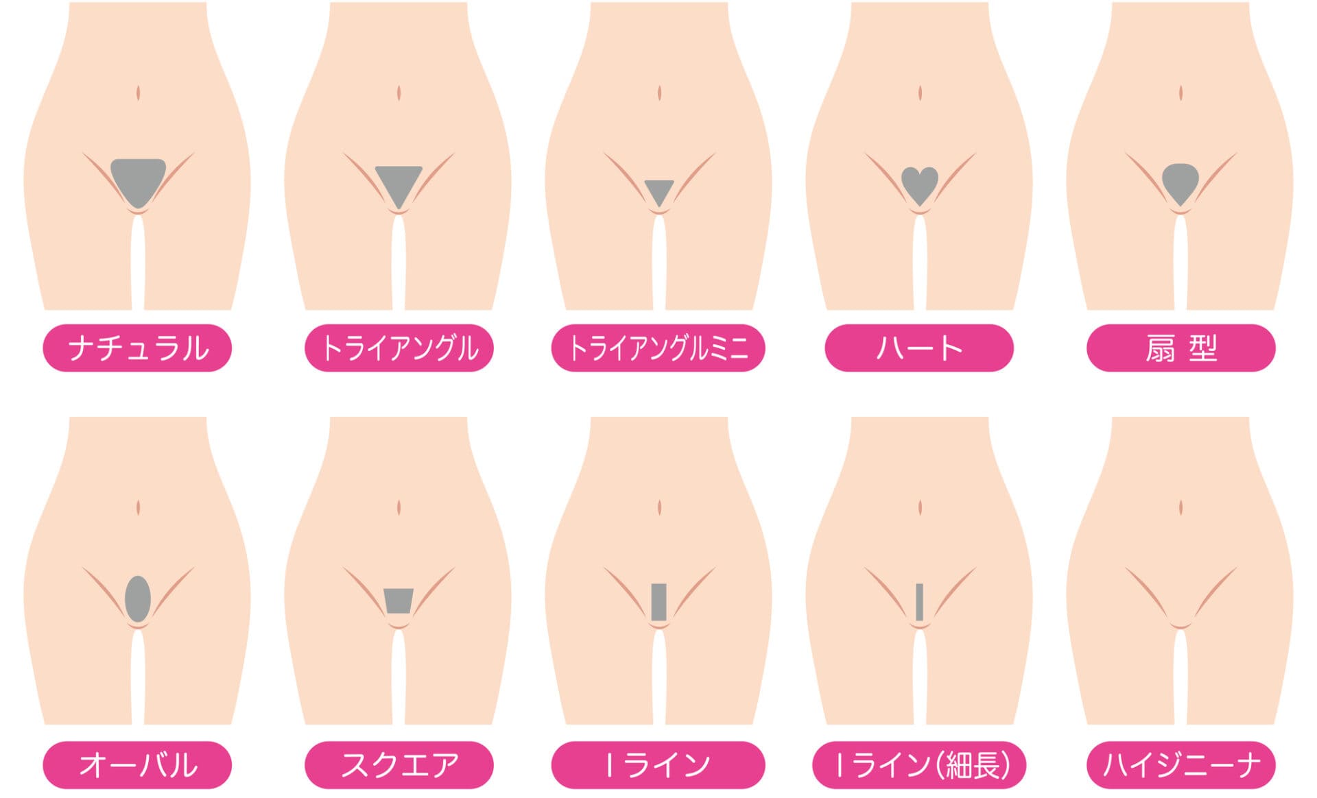VIO脱毛デザイン
